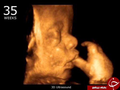 در هفته سی و پنجم، جنین به اندازه یک &laquo;خربزه قندک&raquo; است