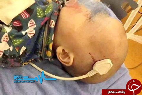 خارج کردن سه&zwnj;شاخه کابل برق از سر یک کودک ۲ ساله +عکس