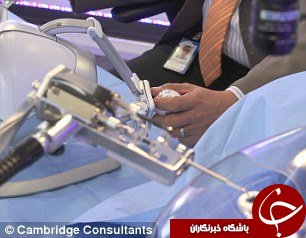 کوچک&zwnj;ترین ربات جراح چشم ساخته شد+عکس