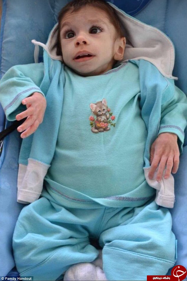 نجات شگفتی ساز کودک 7 ساله ی 3 کیلویی!+ تصاویر