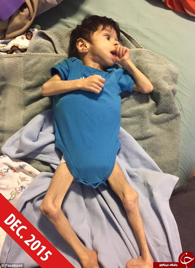 نجات شگفتی ساز کودک 7 ساله ی 3 کیلویی!+ تصاویر