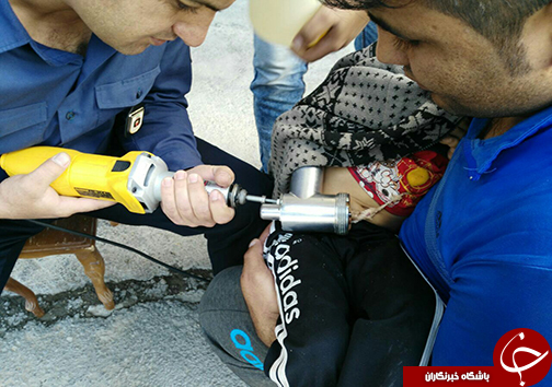 چرخ گوشت، دستان کودک 3 ساله را بلعید+تصاویر