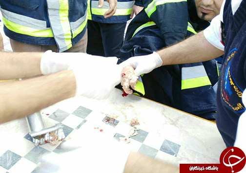 چرخ گوشت، دستان کودک 3 ساله را بلعید+تصاویر