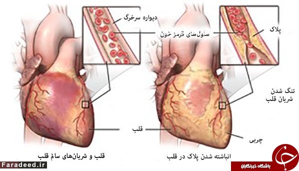 درد قفسه سینه چه زمانی خطرناک است؟