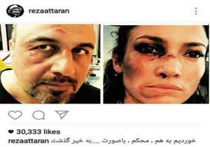 عکس | برخورد رضا عطاران با جنیفر لوپز به‌خیر گذشت