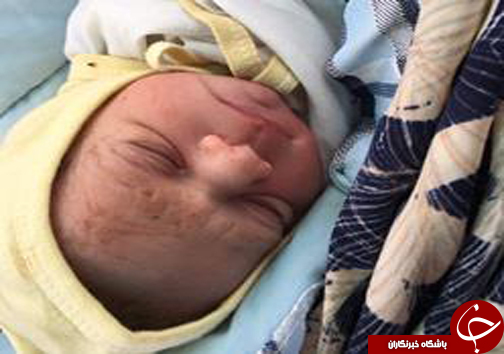 نجات جان مادر و نوزاد از مرگ حتمی در گلستان+ تصاویر