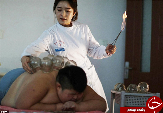 چاق&zwnj;ترین کودک جهان +تصاویر