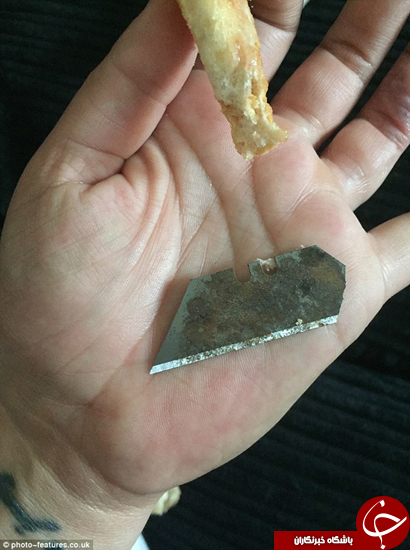 این مرد یک تیغ را خورده است +تصاویر