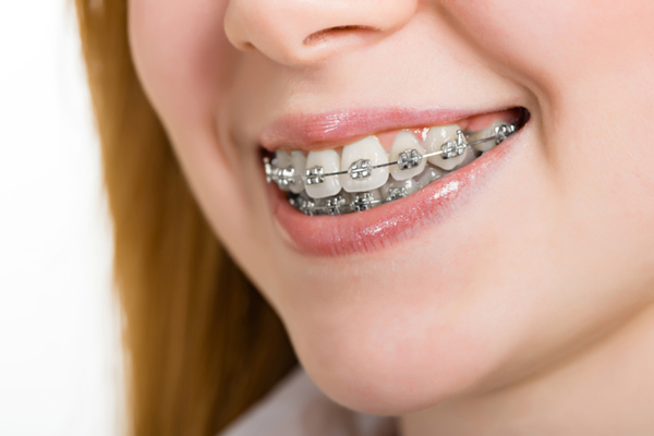 ارتودنسی به قیمت از دست رفتن سلامتی