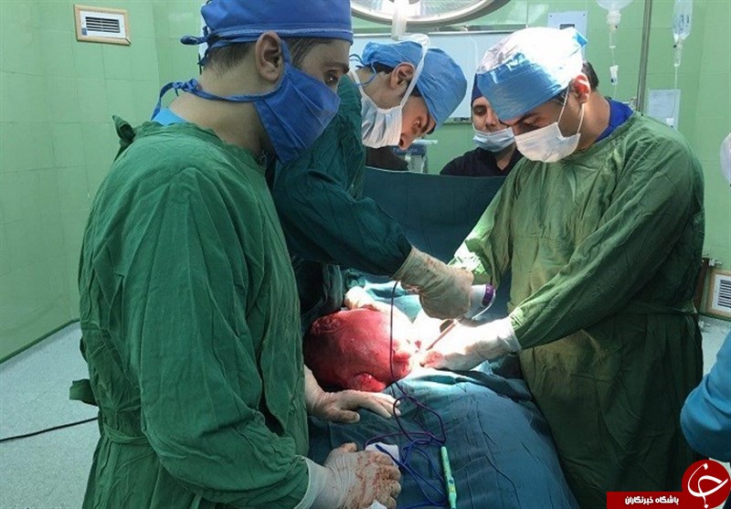 خارج کردن توده ای بزرگ از شکم بیمار ۳۲ ساله در گرگان + تصاویر
