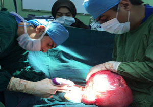 خروج توده بزرگ از شکم زن جوان گلستانی