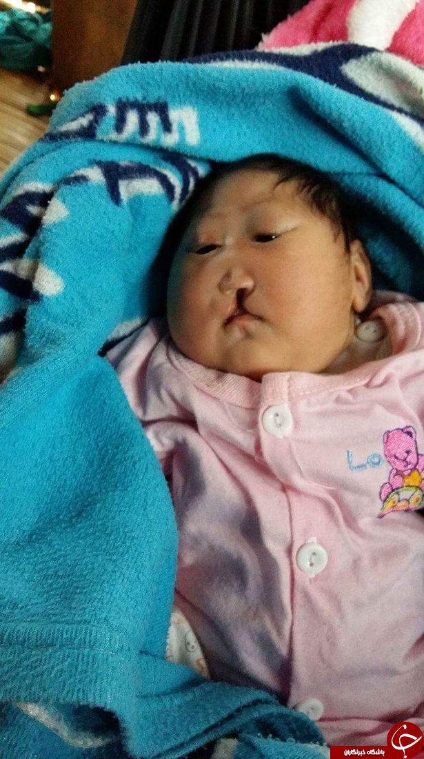 جدال با مرگ کودک تایلندی + تصاویر