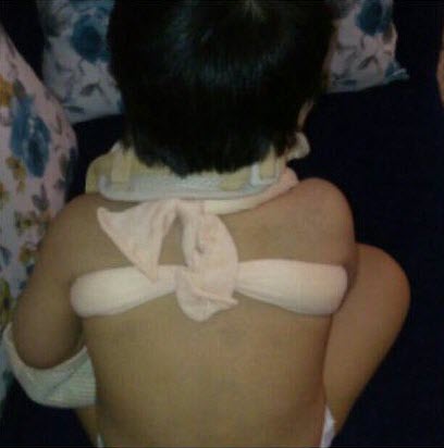 تصویر ضرب و شتم کودک سه ساله در یک مهدکودکِ پایتخت