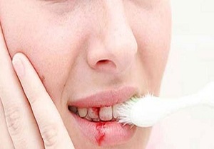 اگر این نشانه ها را دارید، ویتامین بخورید