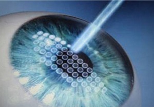 مراقب عملهای زیبایی چشم باشید مراقب عملهای زیبایی چشم باشید