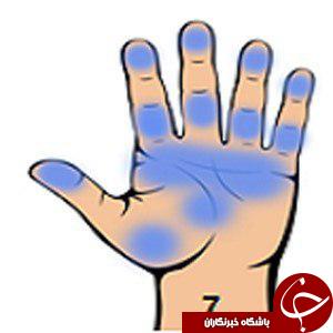 هفت نشانه جدی در بدن را با نگاه کردن به کف دستتان تشخصی دهید/کف دست بینی، این بار برای تشخیص و علاج بیماری