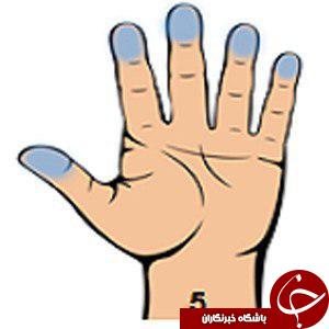 هفت نشانه جدی در بدن را با نگاه کردن به کف دستتان تشخصی دهید/کف دست بینی، این بار برای تشخیص و علاج بیماری