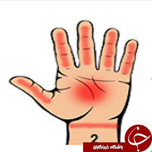 هفت نشانه جدی در بدن را با نگاه کردن به کف دستتان تشخصی دهید/کف دست بینی، این بار برای تشخیص و علاج بیماری