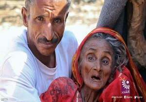 سازمان ملل: یک سوم استانهای یمن در آستانه قحطی قرار دارند