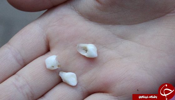 ارتباط جالب خواب های تکراری با ویژگی های شخصیت افراد