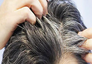 تقویت ریشه&zwnj;های مو با این ماده مفید