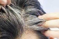 رفع سفیدی مو با شامپو صحت دارد؟