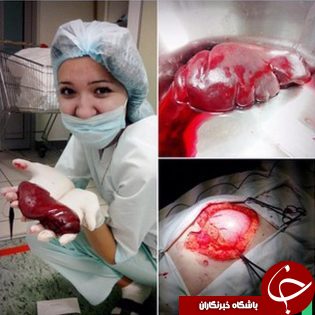 پدیده ای عجیب در صفحات اجتماعی پرستاران/از نوشیدن کیسه خون بیمار تا سلفی با طحال