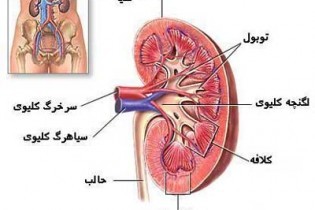 برای سلامتی کلیه ها این نکات را رعایت کنید