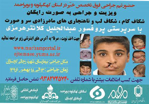 ثبت نام 200 نفر برای بهره مندی از خدمات تیم جراحی پلاستیک در گچساران