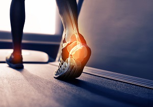 رایج‌ترین علل درد پاشنه پا