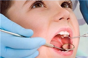لزوم توجه ویژه به پیشگیری در بهداشت دهان و دندان