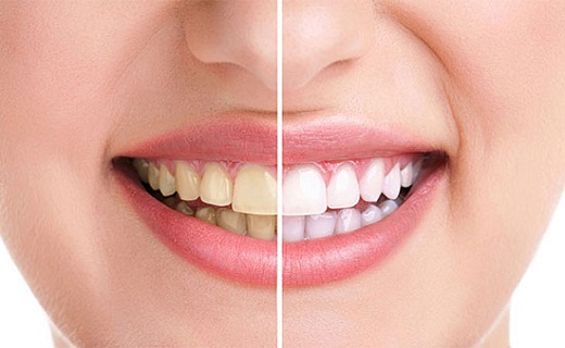 سلامت جنین با محصولات پاستوریزه/ برای سلامتی پوست خود صابون مناسب انتخاب کنید/ اعتیاد در جراحیهای پلاستیک/ دندانهای سالم همیشه سفید نیستند سلامت جنین با محصولات پاستوریزه/ برای سلامتی پوست خود صابون مناسب انتخاب کنید/ اعتیاد در جراحیهای پلاستیک/ دندانهای سالم همیشه سفید نیستند