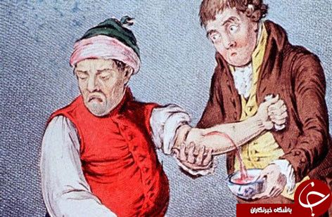 هولناک ترین و عجیب ترین اعمال پزشکی