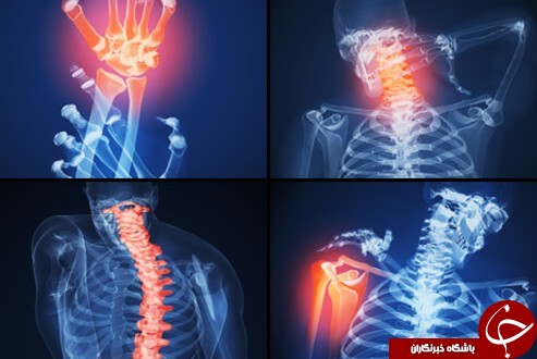 با خوردن این صبحانه به جنگ آرتروز بروید