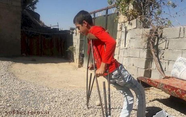 قصه غم انگیز شگفت انگیز ترین معلول دنیا/ شاهین، درآرزوی پرواز
