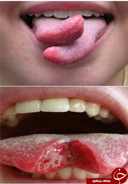 پخش زنده جراحی در اینستاگرام/ جذب مشتری با نمایش قلب و مغز شکافته+ تصاویر