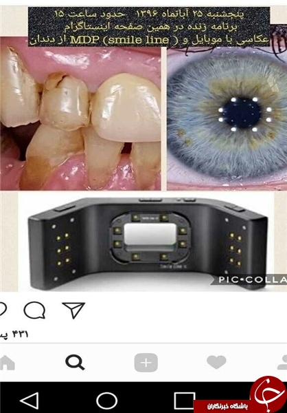 پخش زنده جراحی در اینستاگرام/ جذب مشتری با نمایش قلب و مغز شکافته+ تصاویر