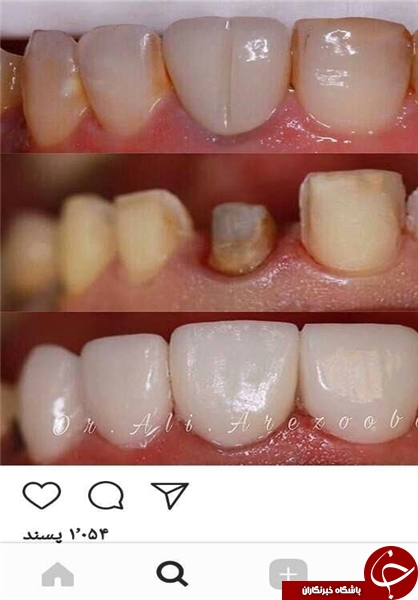 پخش زنده جراحی در اینستاگرام/ جذب مشتری با نمایش قلب و مغز شکافته+ تصاویر