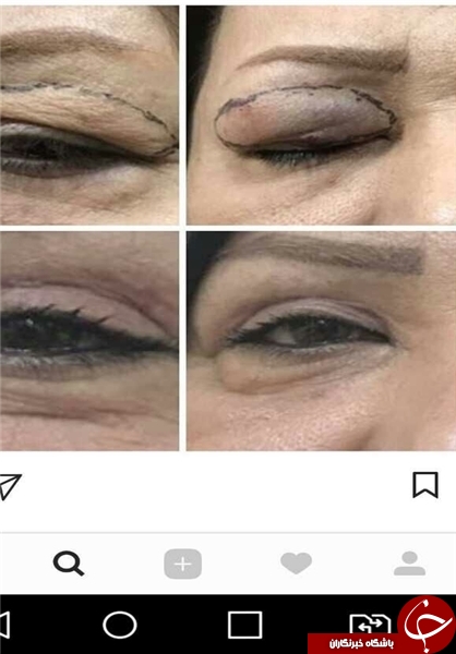 پخش زنده جراحی در اینستاگرام/ جذب مشتری با نمایش قلب و مغز شکافته+ تصاویر