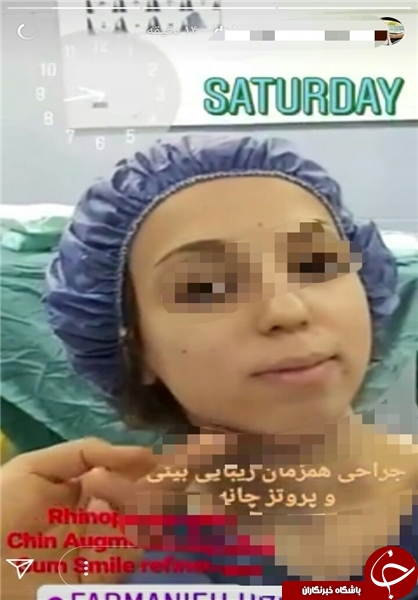 پخش زنده جراحی در اینستاگرام/ جذب مشتری با نمایش قلب و مغز شکافته+ تصاویر