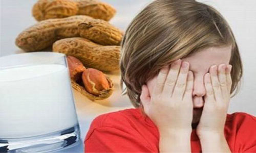 ۵ نشانه هشداردهنده ابتلا به آلرژی غذایی