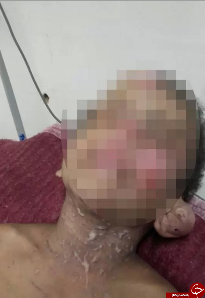 کودک خردسال، قربانی نسخه جادوی سیاه شد/ تصاویر16+