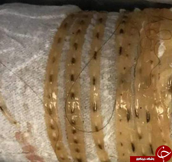 &nbsp;ماجرای هولناک مردی که عاشق یک غذای پرطرفدار اما خطرناک بود! +تصاویر