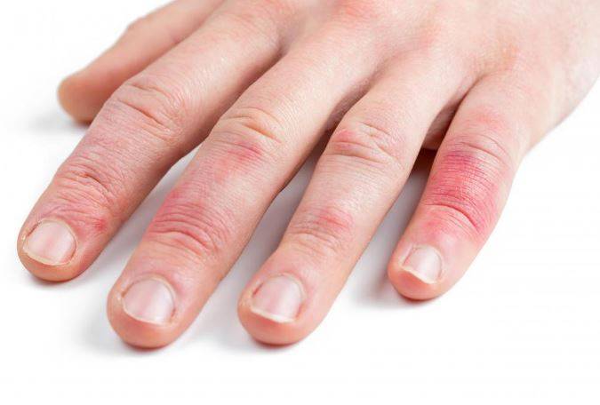 7 عامل ایجاد حساسیت را بشناسید