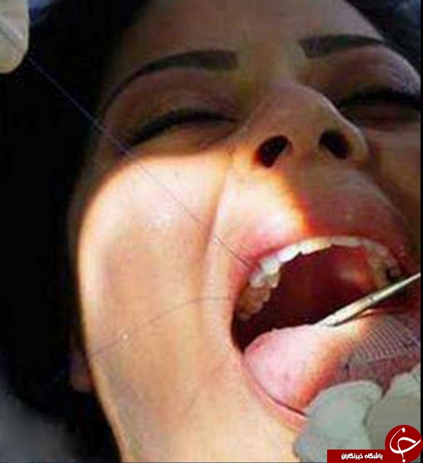 روش دردناک و زجرآور برای لاغری + عکس
