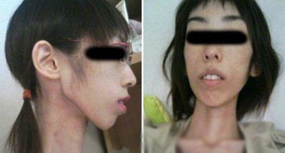 شکنجه عجیب دختر جوان ژاپنی با کاهش وزن +عکس