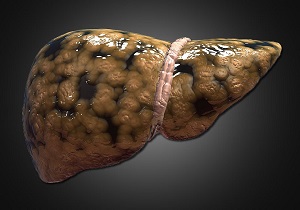 ساخت پیچیده‌ترین مدل کوچک کبدی