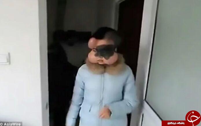شکل عجیب صورت دختر چینی، سوژه رسانه ها شد + تصاویر