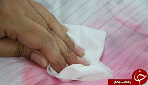 3 ترفند ساده برای لکه بری لباس&zwnj;های سفید