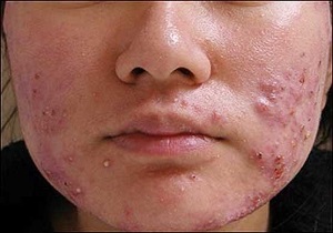 جرم&zwnj;گیری دندان با 6 ماده طبیعی و موثر خانگی/اتفاق عجيب در فوتبال ؛مسى و نيمكت نشينى!/ انسان چگونه &laquo;عروس شیطان&raquo; می&zwnj;شود؟/مقدار خواب طبیعی افراد در هر سن چقدر است؟